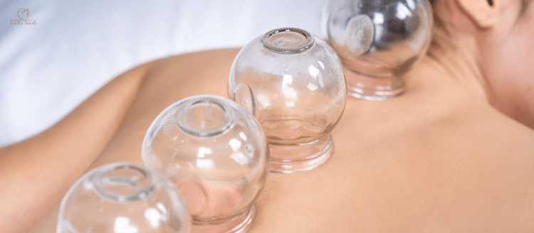 Cupping